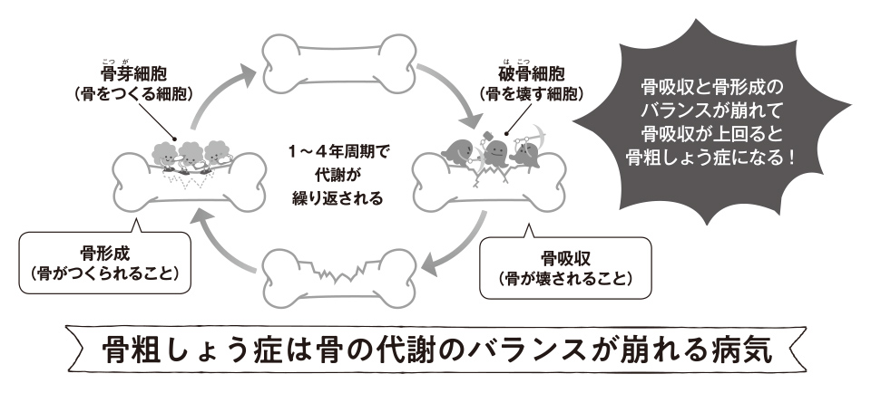 高齢者の「薬」＆生活への影響【骨粗しょう症治療薬】