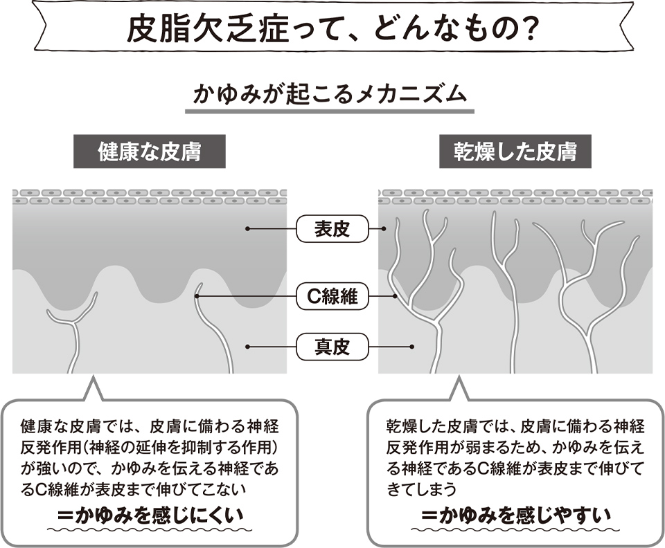 高齢者の「薬」＆生活への影響【皮脂欠乏症（ドライスキン等）治療薬】