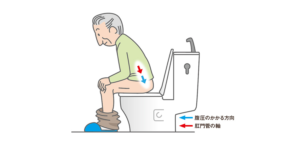 利用者が「何に困っているか」見極める　排泄ケア②